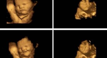 Cosa piace mangiare ai bimbi in grembo? Le ecografie mostrano sorrisi e smorfie in base al cibo